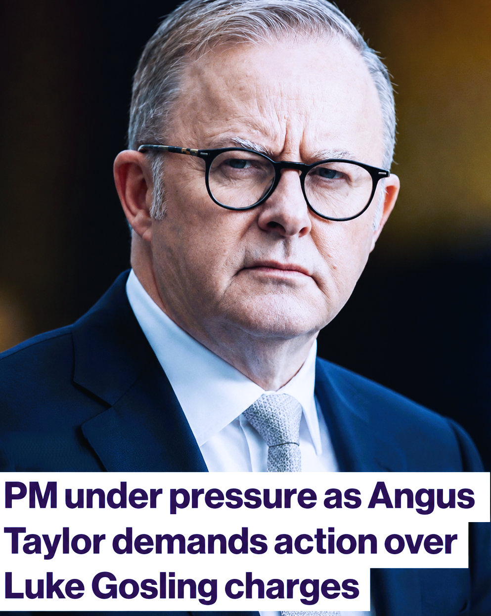 Anthony Albanese faces political pressure over Labor MP Luke Gosling's assault charges